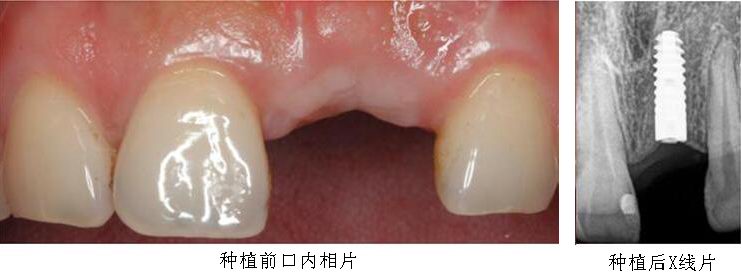 沐鸣娱乐_沐鸣平台登录-官方授权注册效劳中心