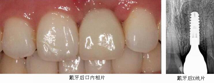 沐鸣娱乐_沐鸣平台登录-官方授权注册效劳中心