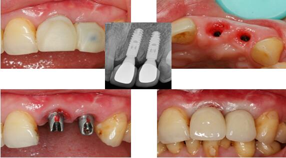 沐鸣娱乐_沐鸣平台登录-官方授权注册效劳中心