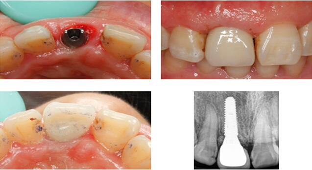 沐鸣娱乐_沐鸣平台登录-官方授权注册效劳中心