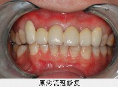 沐鸣娱乐_沐鸣平台登录-官方授权注册效劳中心