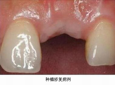 沐鸣娱乐_沐鸣平台登录-官方授权注册效劳中心